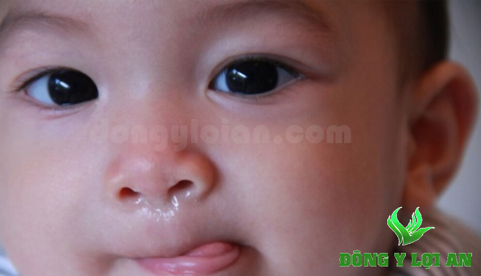 Mẹo trị sổ mũi cho trẻ sơ sinh 2 tháng tuổi