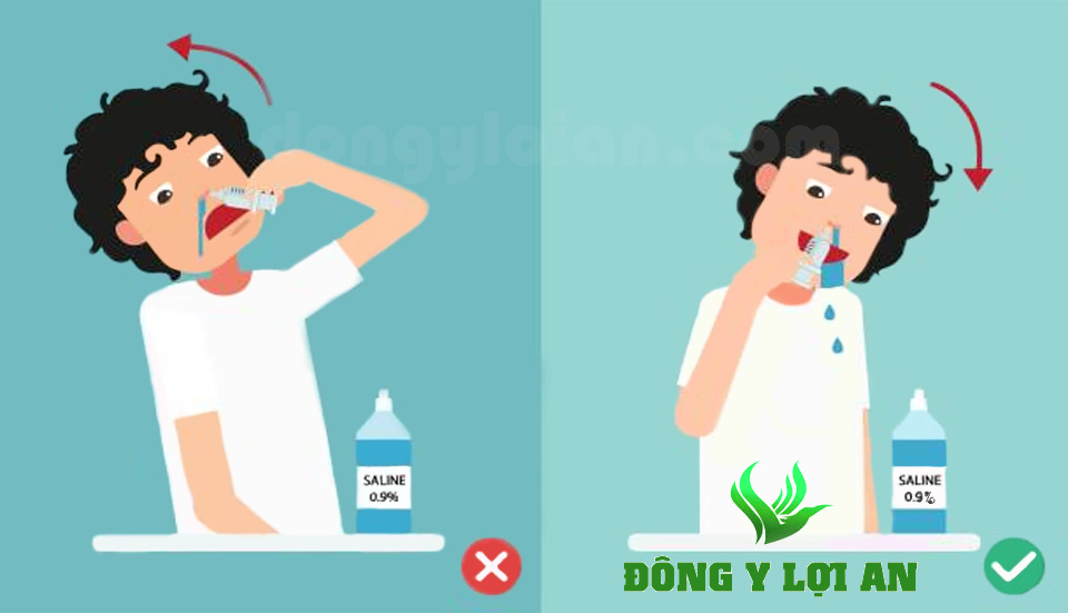 Sử dụng nước muối sinh lý để rửa và vệ sinh mũi