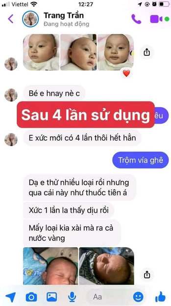 Bé bị chàm sữa đã khỏi khi sử dụng kem bôi da Lợi An