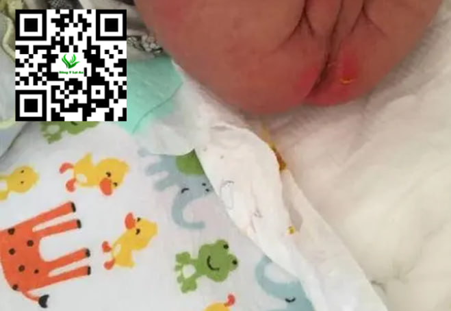 Bôi Kem Quá Nhiều Hoặc Quá Ít