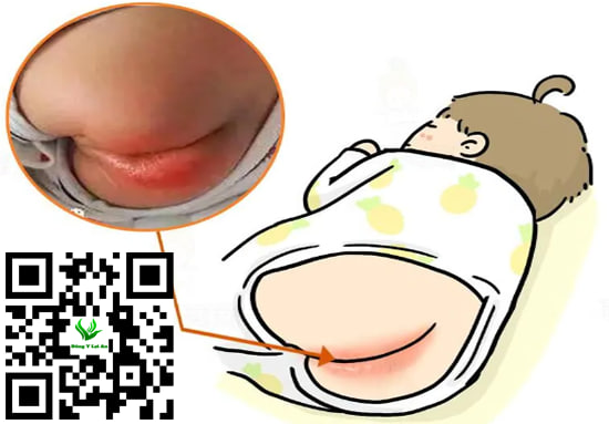 Chọn Kem Dưỡng An Toàn Cho Da Bé