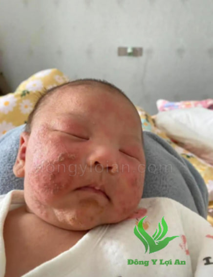 Lợi ích tiềm năng của NMT cho trẻ sơ sinh