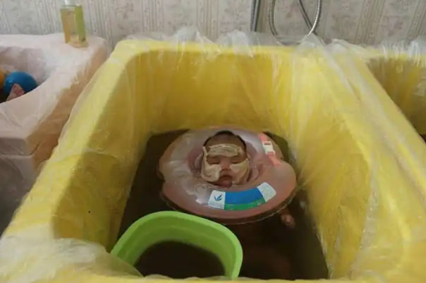 Nước Tắm lá sả hỗ trợ bé hết chàm