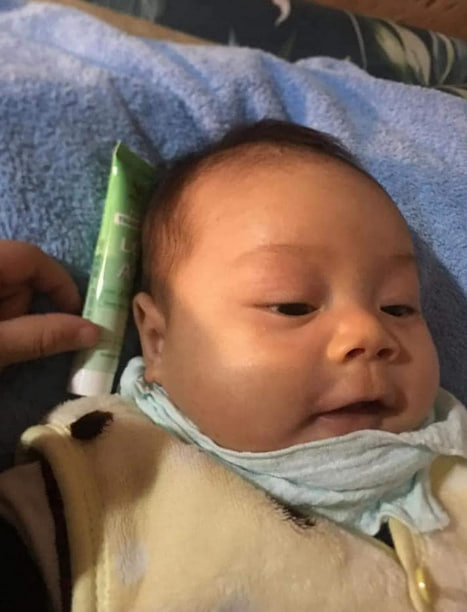 Sau khi dùng kem bôi thảo dược chữa chàm sữa ở trẻ sơ sinh đã hết