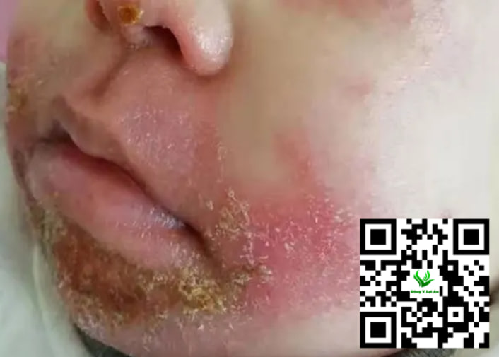 Sử dụng bôi kem cho từng vị trí