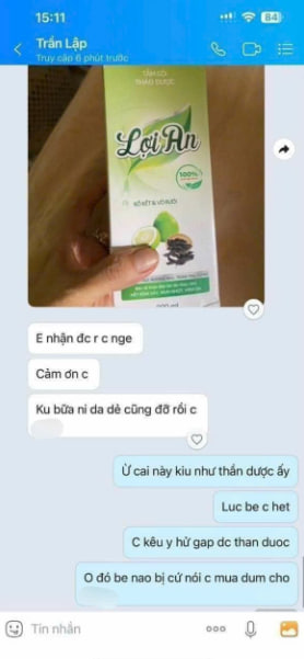 Da giảm rôm sảy, mẩn đỏ mát dịu