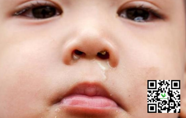 Bé giảm sổ mũi khi mẹ ăn uống điều độ