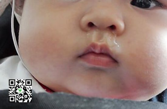 Các thực phẩm mẹ cần kiêng khem tránh bé bị sổ mũi