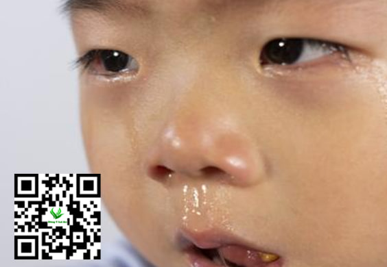 Cách chăm sóc bé sổ mũi ho kéo dài tại nhà