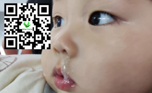 Cách để biết trẻ sơ sinh 1 tháng tuổi có đang bị sổ mũi