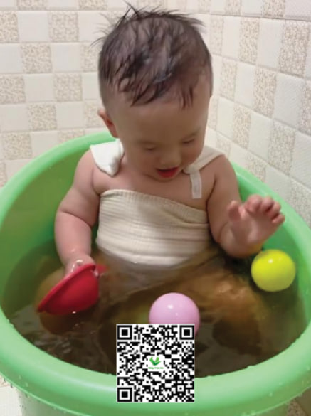 Cách trị hăm bắng lá khế cho bé