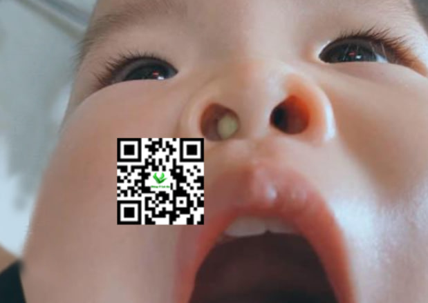 Dấu hiệu phổ biến của nghẹt mũi và đờm ở trẻ sơ sinh