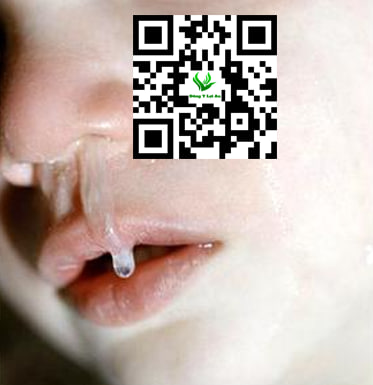 Dịch nhầyy nhiều gây thở khò khè ở trẻ