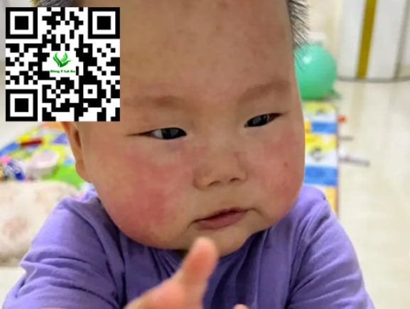 Chỉ bao gồm di truyền, môi trường, và phản ứng của hệ miễn dịch