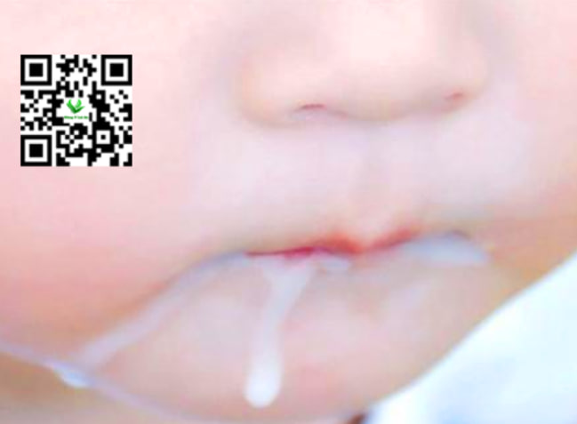 Nguyên Nhân Khiến Trẻ Không Ho Nhưng Có Đờm Ở Cổ Họng