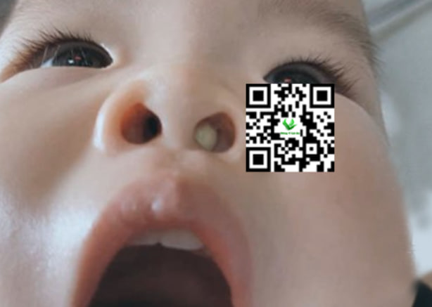 Nguyên nhân nghẹt mũi 1 bên do dịch mũi