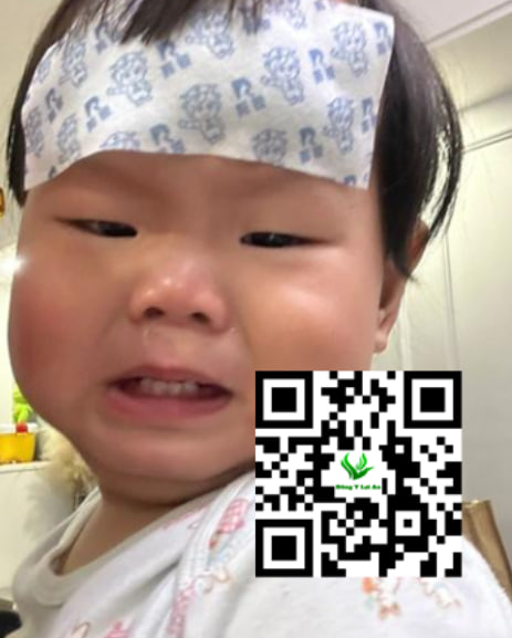 Nguyên nhân phổ biến của ho, sốt, sổ mũi