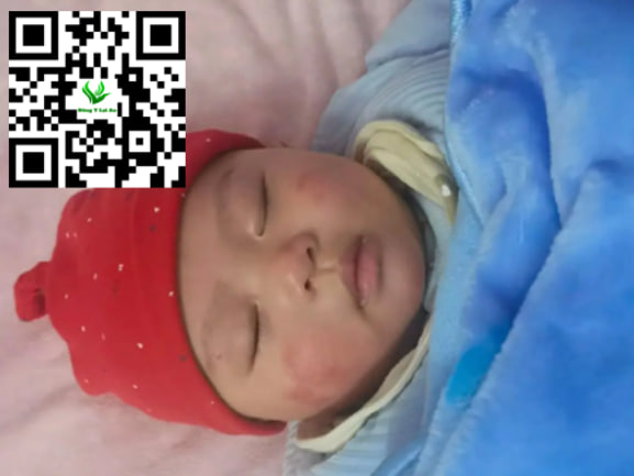 Tác động tâm lý hoặc các vấn đề khác