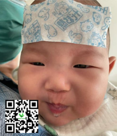 Trẻ bị ho sốt sổ mũi kéo dài có thể gây biến chứng gì