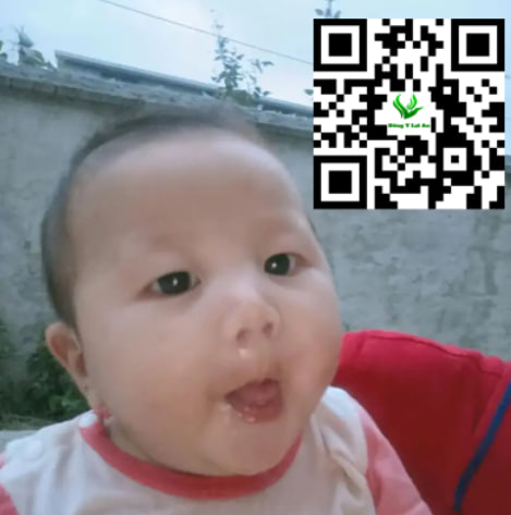 Trẻ bị ho sốt sổ mũi uống thuốc gì​