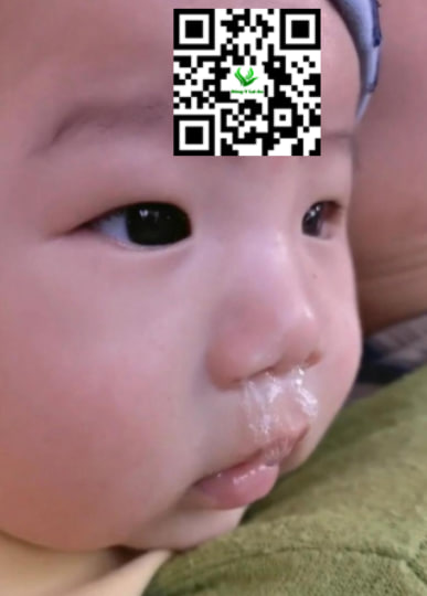 Trẻ sơ sinh 1 tháng tuổi bị sổ mũi phải làm sao