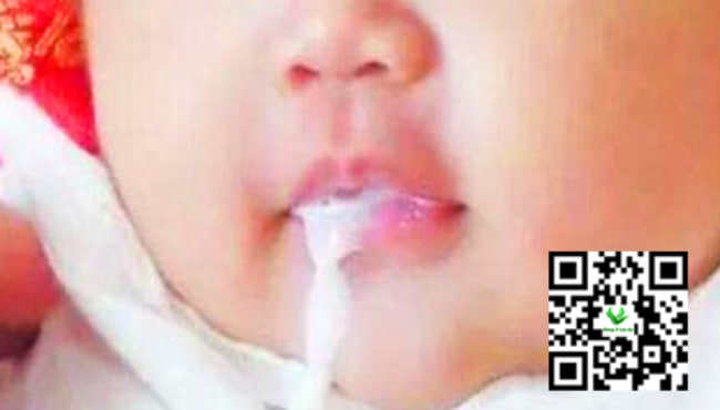 Trẻ sơ sinh có đờm nhưng không ho