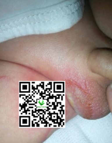 Vùng Da Bìu Luôn Khô Ráo Tránh Hăm