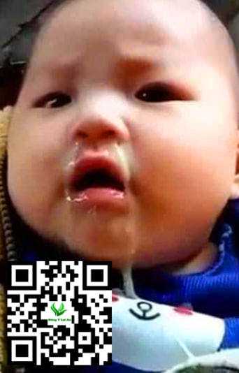 Nhiều chất nhầy hơn để bảo vệ niêm mạc mũi