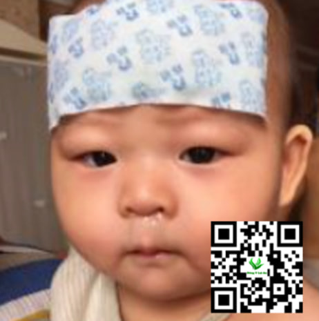 Trẻ bị sốt, ho, và sổ mũi, việc điều trị tại nhà với các phương pháp tự nhiên