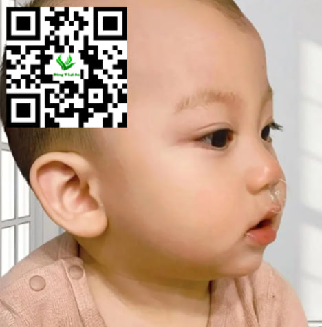 trẻ sơ sinh bị ho, sổ mũi và thở khò khè chăm sóc và điều trị tại nhà