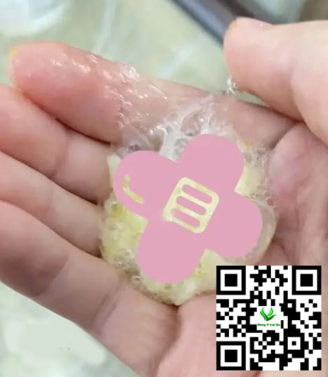 Triệu chứng của trẻ khi bị sổ mũi xanh và ho có đờm